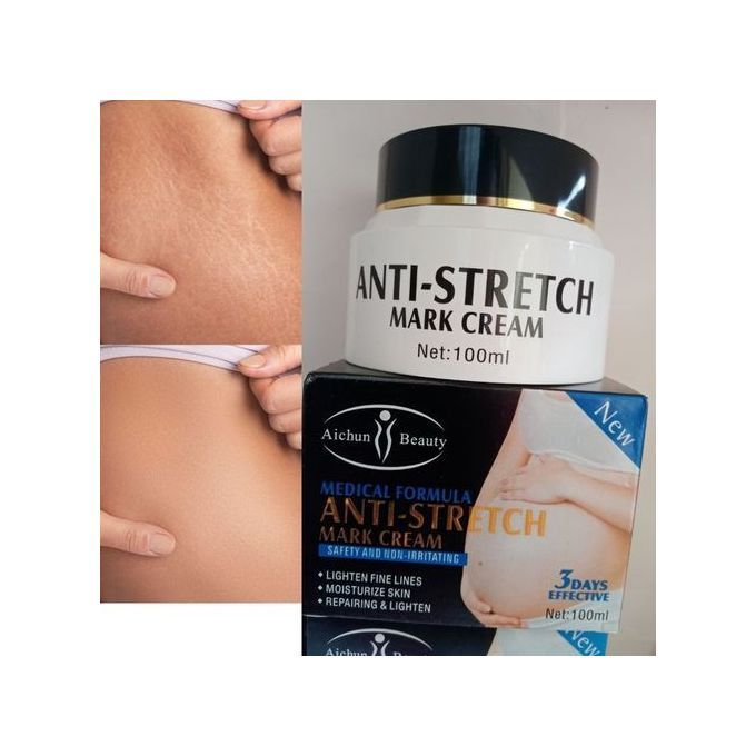 Crema ANTI ESTRIAS