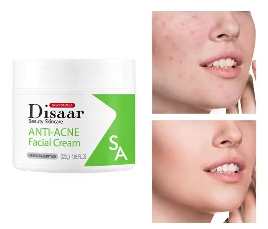 Crema Facial Antiacné