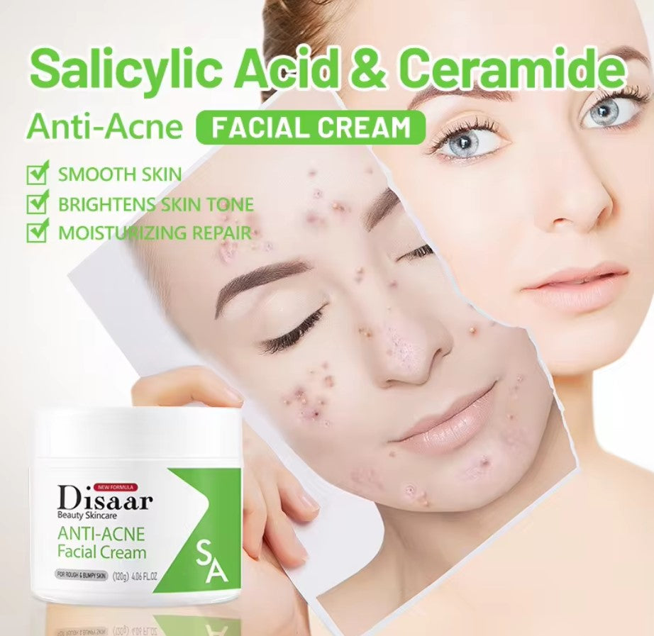 Crema Facial Antiacné