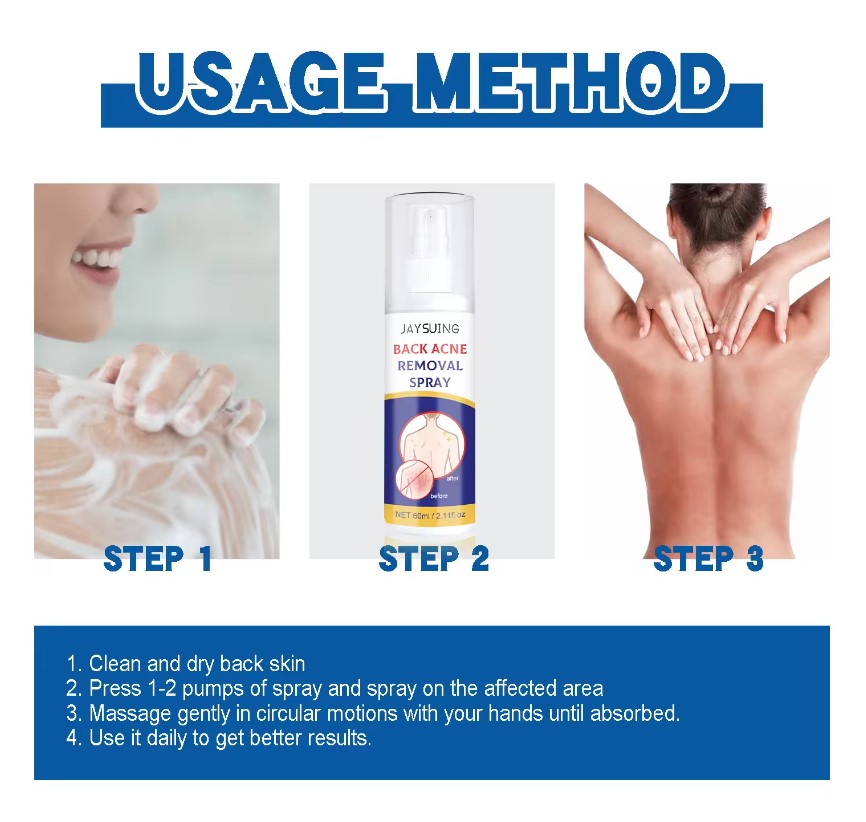 Spray para Remover Acné de la Espalda