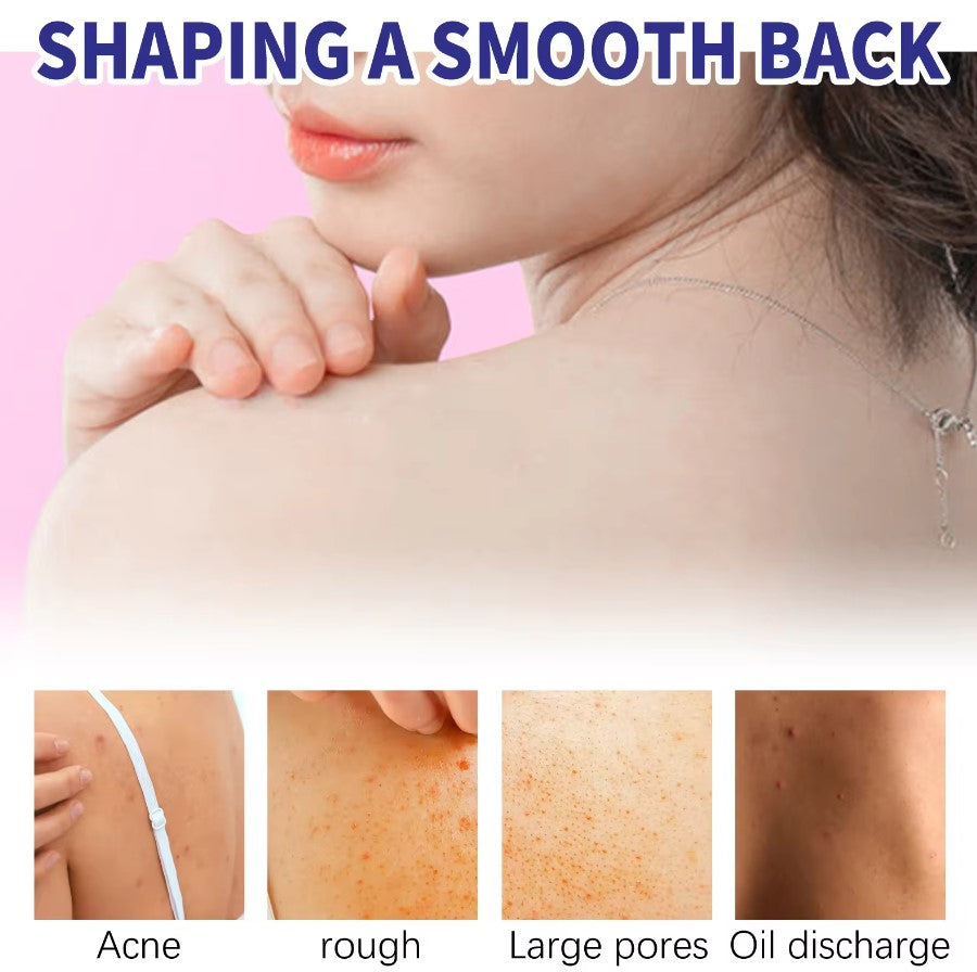 Spray para Remover Acné de la Espalda