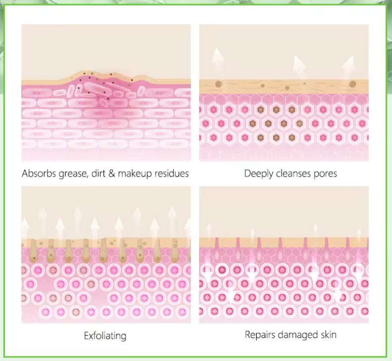 Crema Facial Antiacné