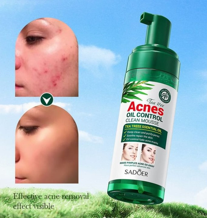 Kit Facial de Árbol de Te Control de Grasa y Acné