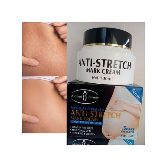 Crema ANTI ESTRIAS