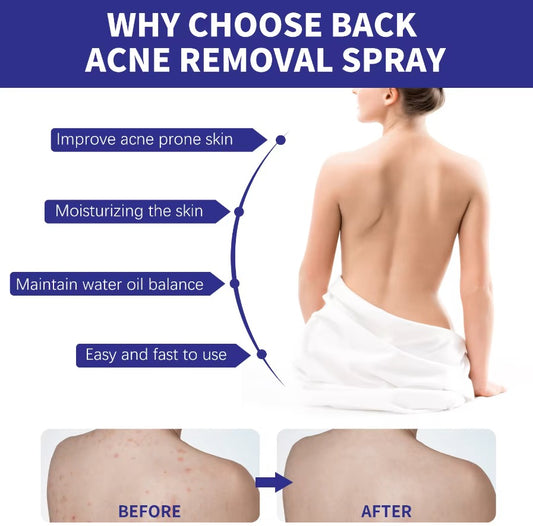 Spray para Remover Acné de la Espalda