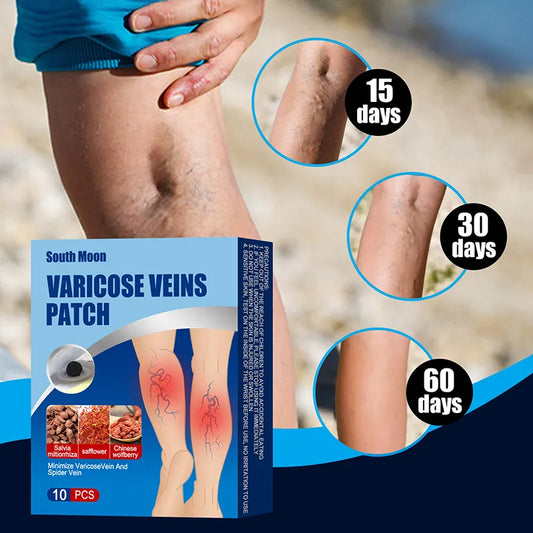 Parches varices.